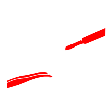 Carotid Endarterectomy